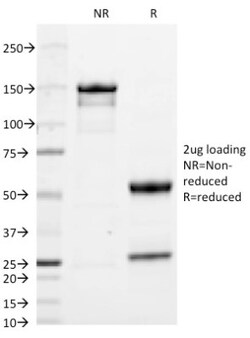 IgA Antibody (HISA43), Novus Biologicals 0.2mg; Unlabeled:Antibodies, Monoclonal